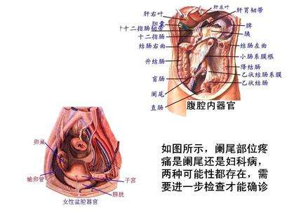 卵巢和阑尾的位置图片