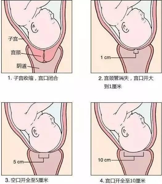 自然分娩过程 流程图图片